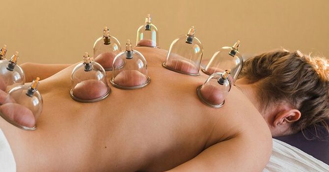 Cupping